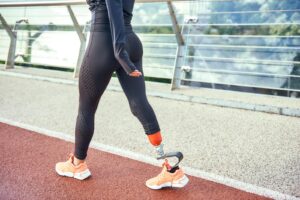 Read more about the article Jak wygląda wykonanie protezy kończyny? Rodzaje protez, materiały, krok po kroku