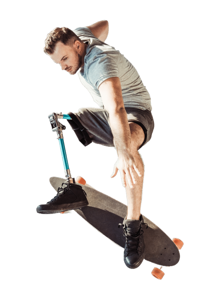 Mężczyzna na desce skateboardowej, wykonujący tricki z protezą nogi.