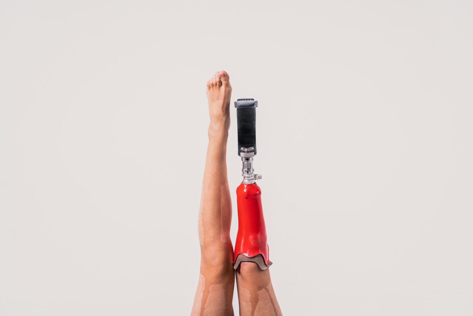 Beautiful woman with prosthesis leg