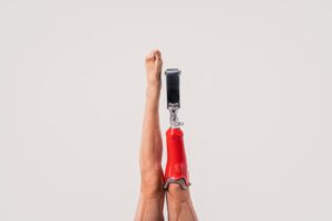 Beautiful woman with prosthesis leg